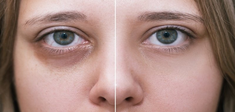 adobestock 409671118 scaled