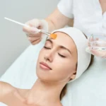 can acne scars be treated by chemical peeling scaled