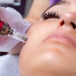 mnrf treatment in chennai