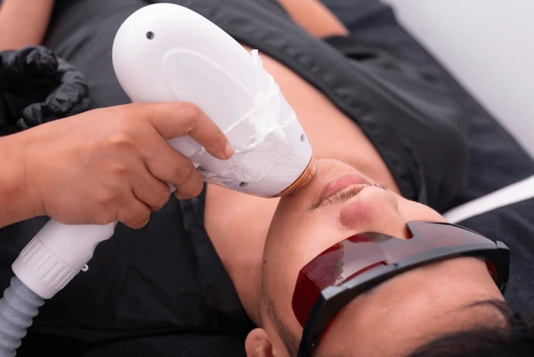 diode ice laser hair removal 600nw 2476013277