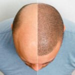 istockphoto 1359870624 612x612