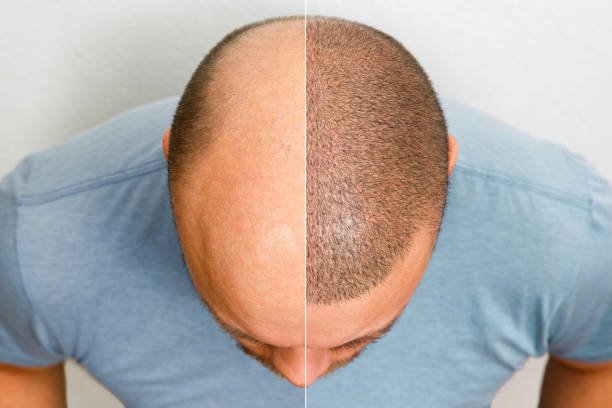 istockphoto 1359870624 612x612