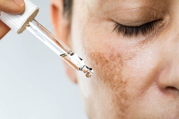 istockphoto 1456638962 612x612