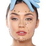 non surgical facelift in kerala