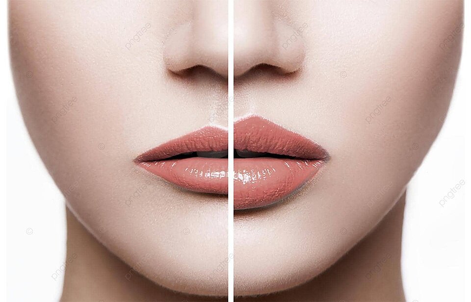 pngtree before and after lip augmentation a closeup of feminine lips photo image 47311464