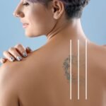 post tattoo removal aftercare