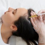 prp treatment