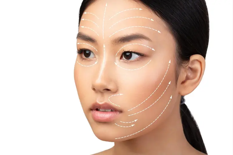 treatment es facelift 768x512