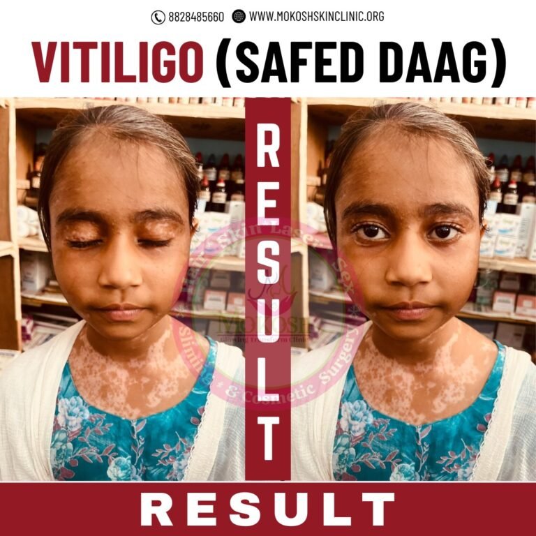 viti4