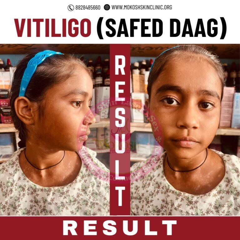 viti6